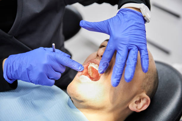 Best Dental Abscess Treatment in Cave Spring, VA